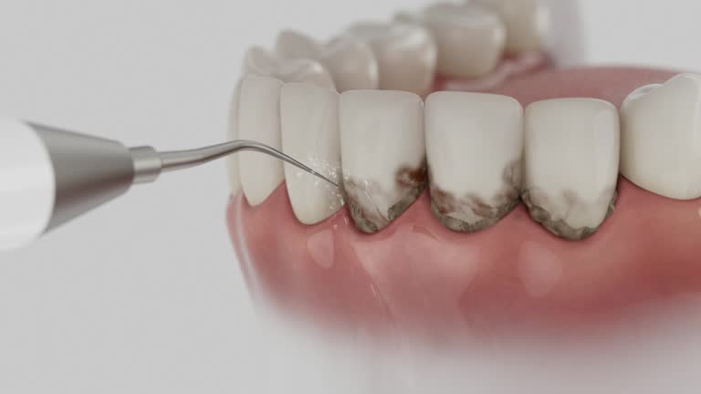 Reliable Dental contractor in Cassville, WV by Dentist Open Now